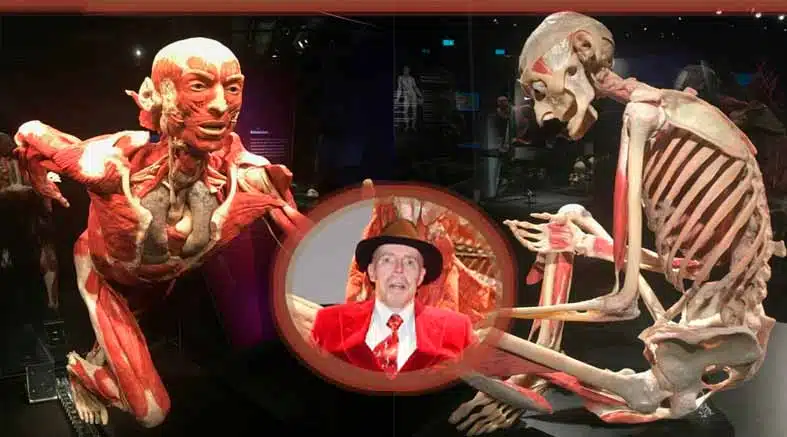 plastinación